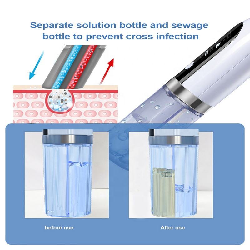 ORANGLES MicroBubble Blackhead Remover – Electric Pore Vacuum & Water Cycle Cleaner - angled perspective - presenting advantages - Image 4 of 6 | fits any environment | Purchase MicroBubble Blackhead Remover – Electric Pore Vacuum & Water Cycle Cleaner Michigan | Free Shipping ORANGLES